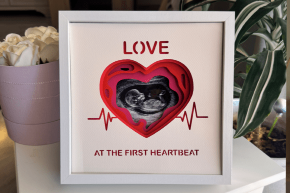 Preserve Baby Ultrasound Photos in a 3D Shadow Box